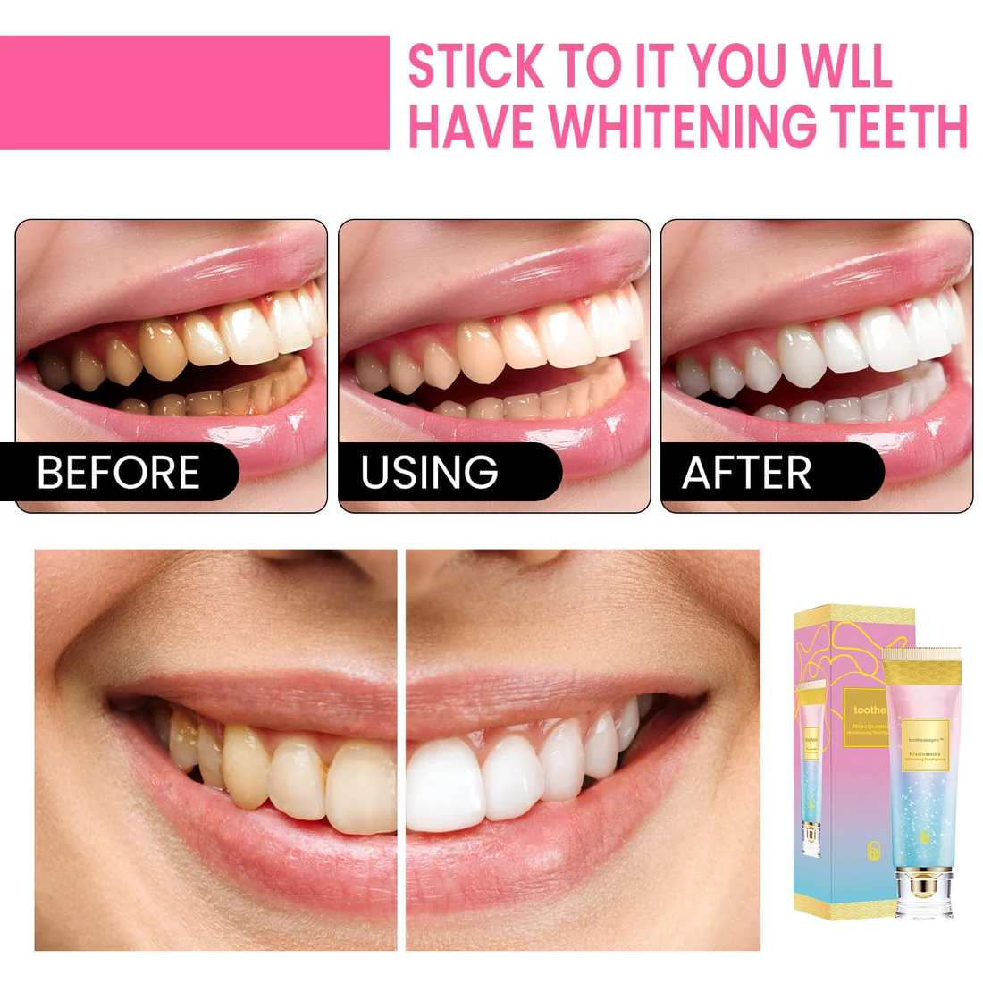 ToothEasePro™ Niacinamide Whitening Toothpaste💖💖