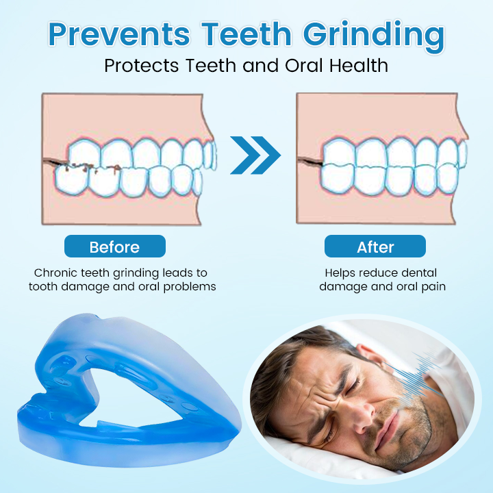 ✨[Official Brand Store] BBOJI™ Adjustable Anti-Snoring Mouthpiece Universal Size
