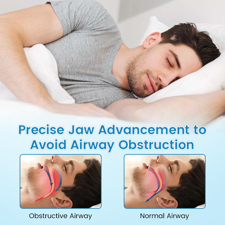 ✨[Official Brand Store] BBOJI™ Adjustable Anti-Snoring Mouthpiece Universal Size