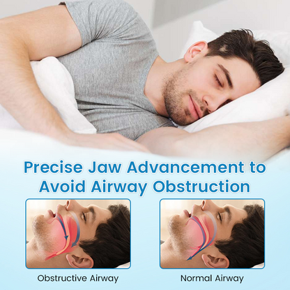 ✨[Official Brand Store] BBOJI™ Adjustable Anti-Snoring Mouthpiece Universal Size