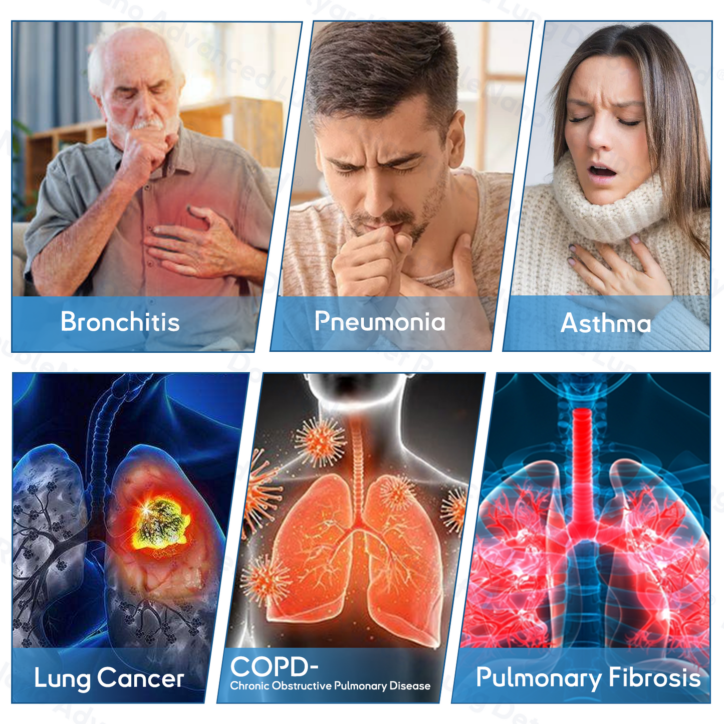 😽✨𝐎𝐟𝐟𝐢𝐜𝐢𝐚𝐥 𝐒𝐭𝐨𝐫𝐞:ClearLungX™ 𝐃𝐨𝐮𝐛𝐥𝐞𝐍𝐚𝐧𝐨 𝐀𝐝𝐯𝐚𝐧𝐜𝐞𝐝 𝐋𝐮𝐧𝐠 𝐃𝐞𝐭𝐨𝐱 𝐑𝐞𝐥𝐢𝐞𝐟 𝐏𝐚𝐭𝐜𝐡✨𝐅𝐃𝐀  𝐀𝐩𝐩𝐫𝐨𝐯𝐞𝐝
