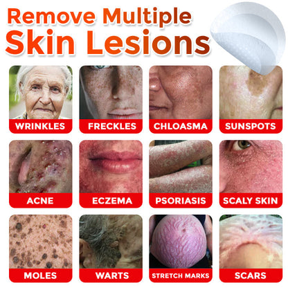 🌈🌈SkinPrikyn™ MicroNeedle Botanic Skin Tag Removal Patch 🇺🇸 Made in the USA